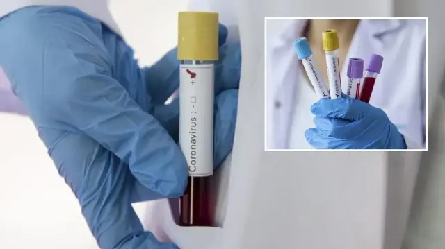 zayiflar kovid 19u daha agir geciriyor bUpu6YlW.webp